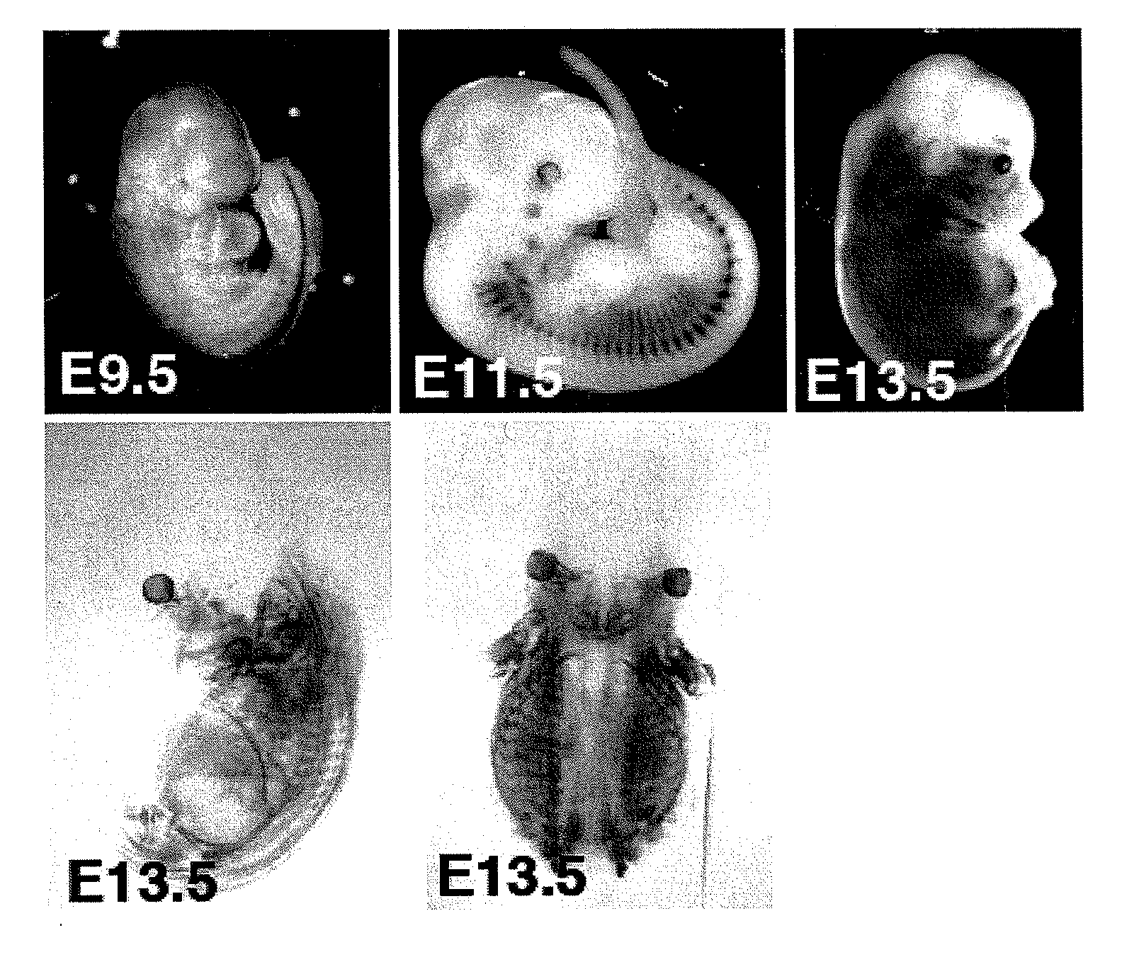 MICRO-RNAs THAT MODULATE SMOOTH MUSCLE PROLIFERATION AND DIFFERENTIATION AND USES THEREOF