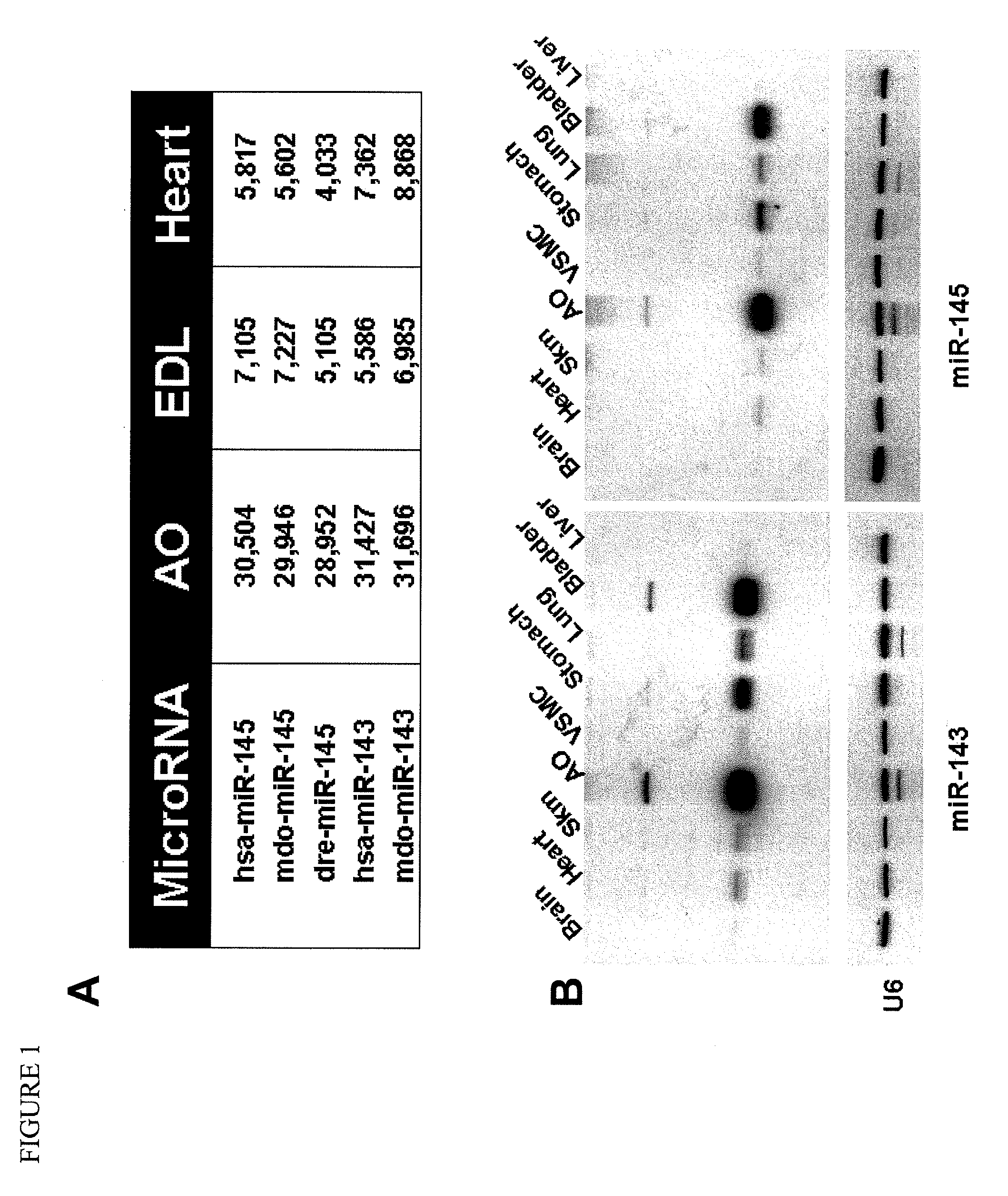 MICRO-RNAs THAT MODULATE SMOOTH MUSCLE PROLIFERATION AND DIFFERENTIATION AND USES THEREOF