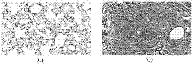 Establishment method of silicosis pulmonary fibrosis animal model and special intubation device