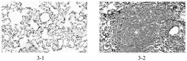 Establishment method of silicosis pulmonary fibrosis animal model and special intubation device