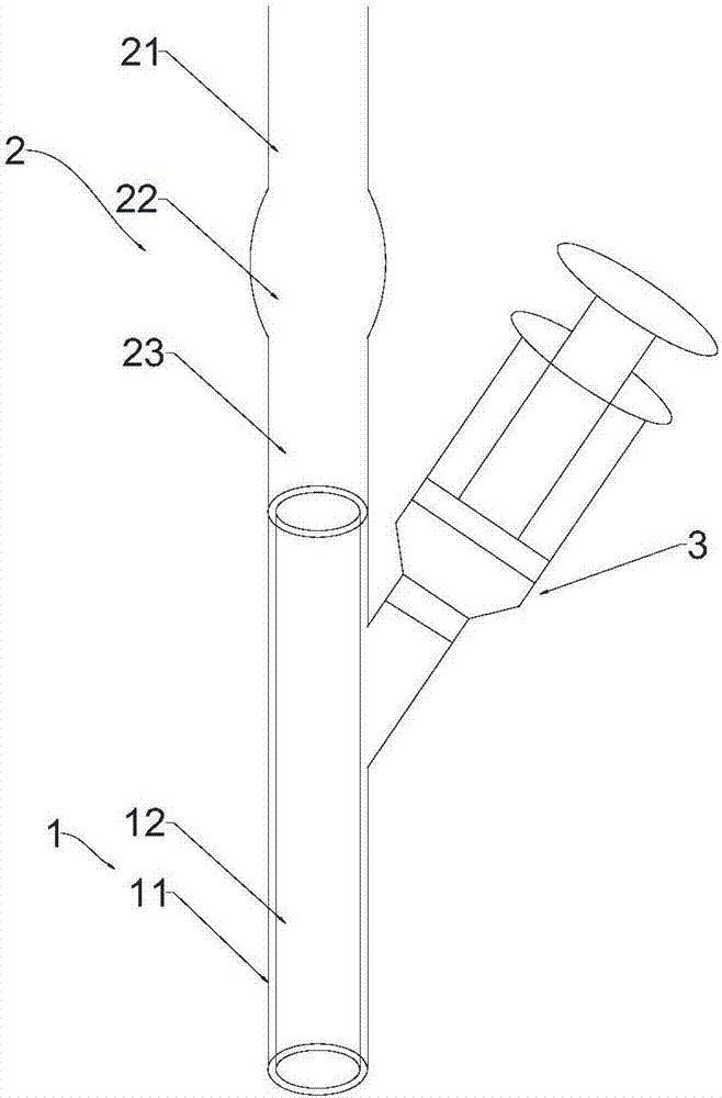 Establishment method of silicosis pulmonary fibrosis animal model and special intubation device