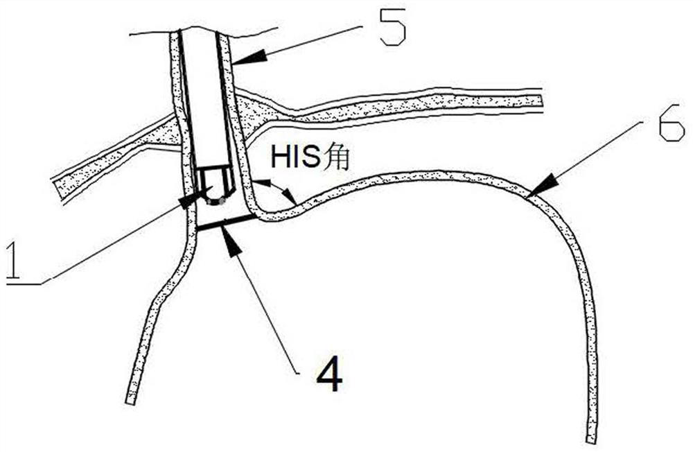 Endoscope device and system for treating gastroesophageal reflux disease and control method of endoscope device and system