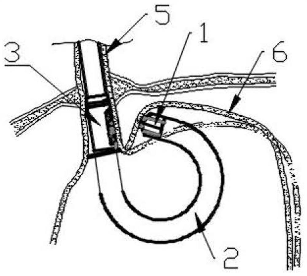 Endoscope device and system for treating gastroesophageal reflux disease and control method of endoscope device and system