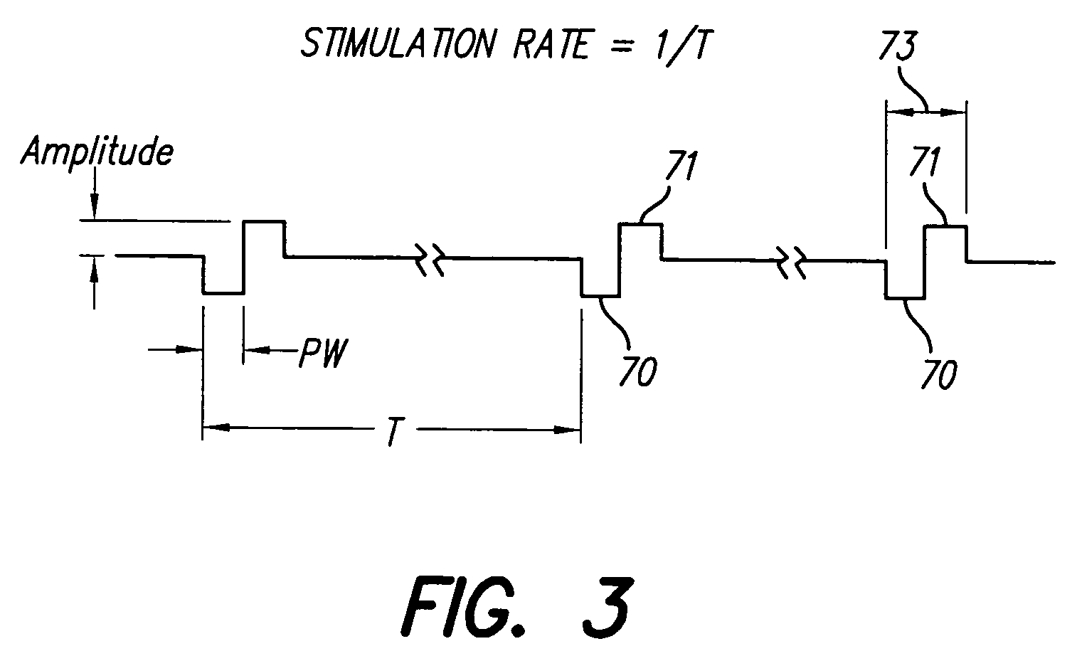 Method for determining stimulation parameters