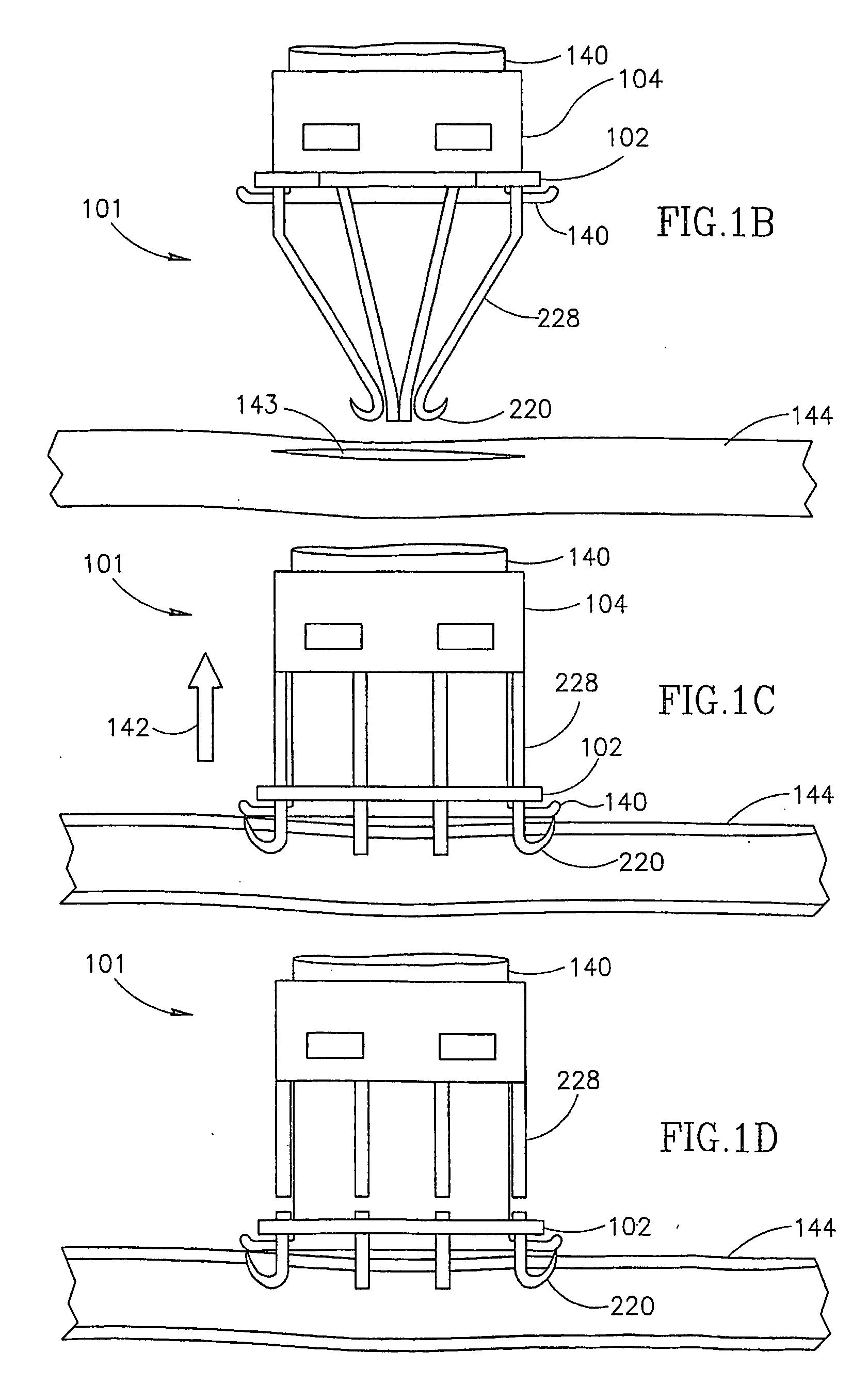 Anastomotic delivery system