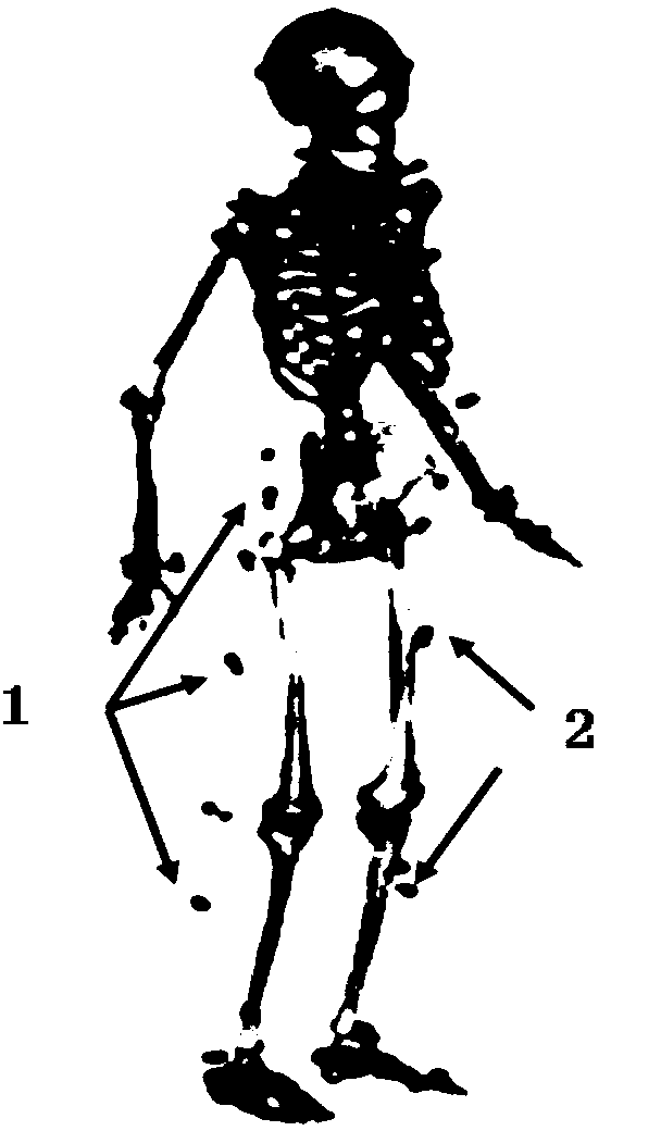 Pedestrian navigation system and navigation positioning method based on kinesiology model