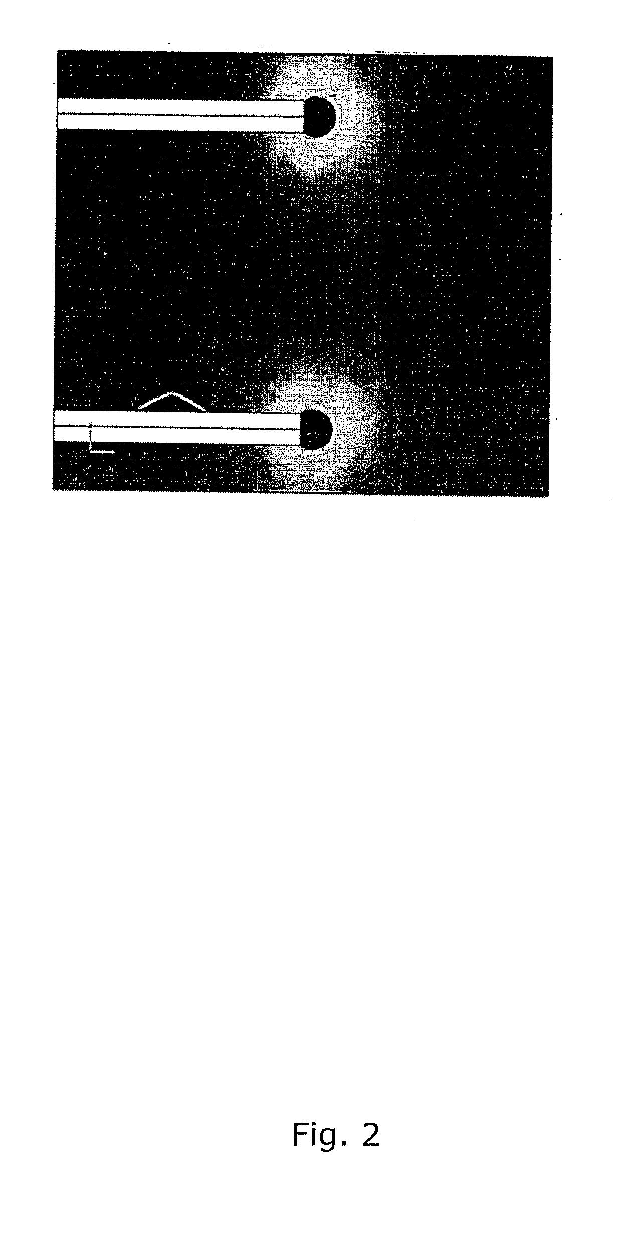 Electroporation device for improved electrical field control