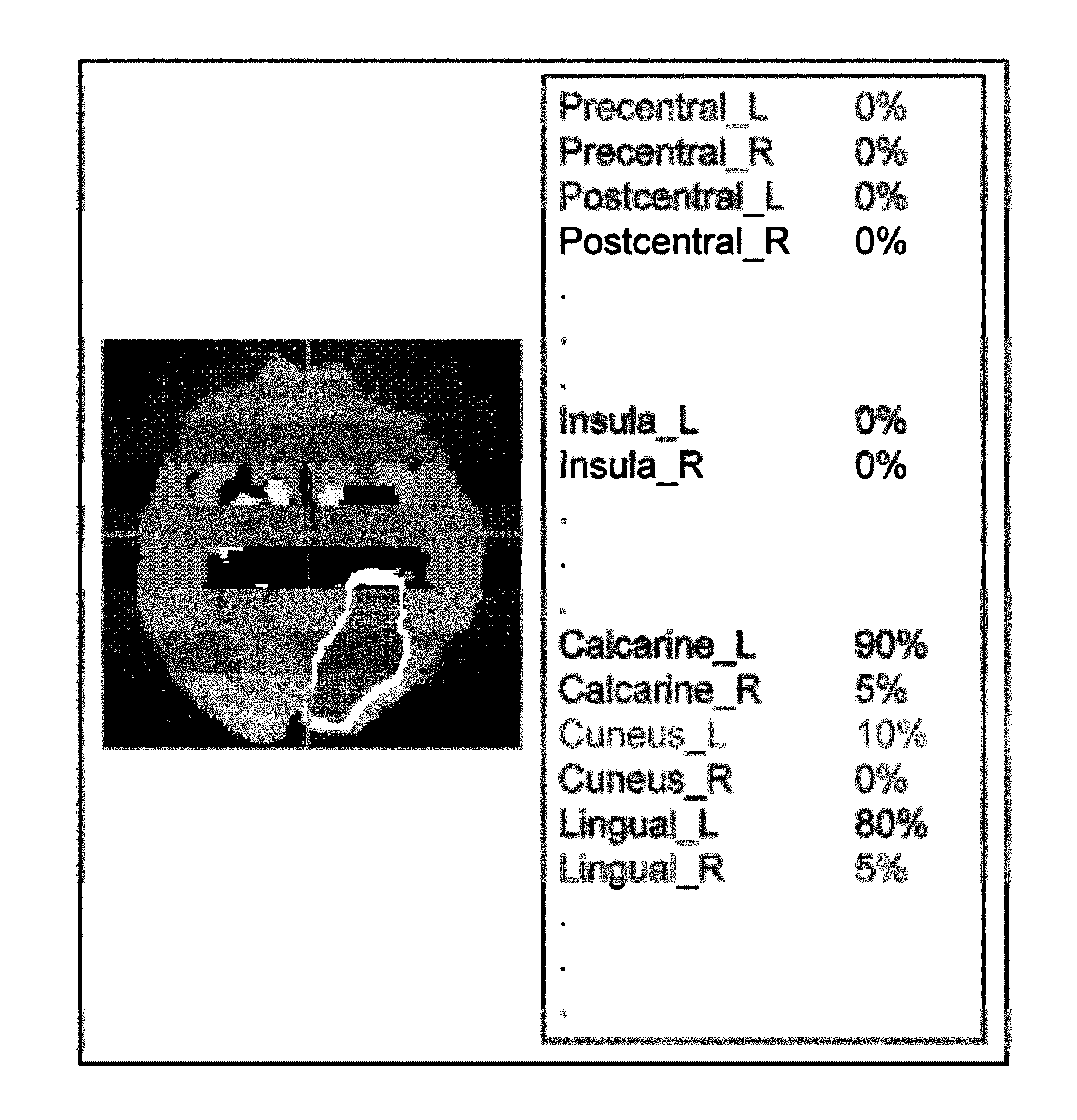 Brain disease diagnosis service apparatus and brain disease diagnosis service method