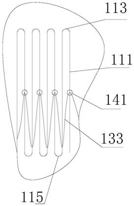 Lumen stent