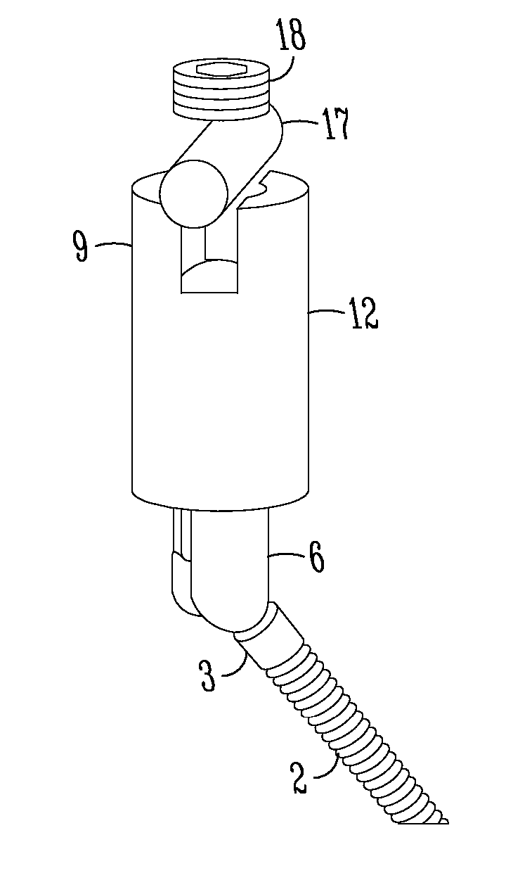 Pedicle screw with vertical adjustment