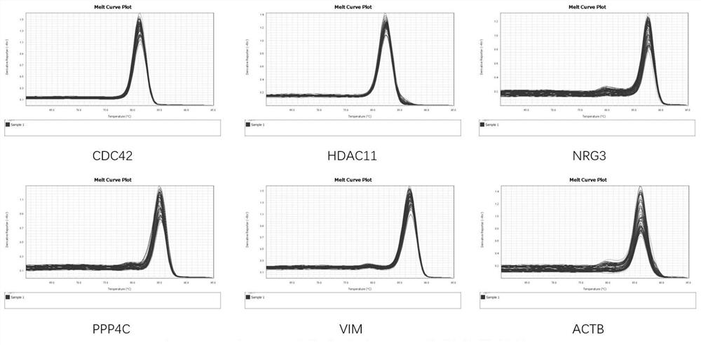 Application of immune-related genes in kit and system for predicting prognosis of diffuse glioma