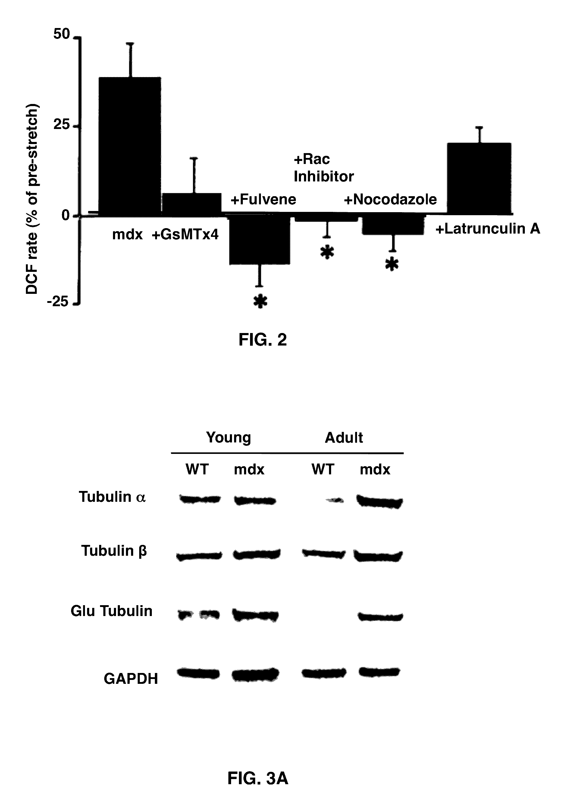 Treatment of muscular conditions and muscular dystrophies