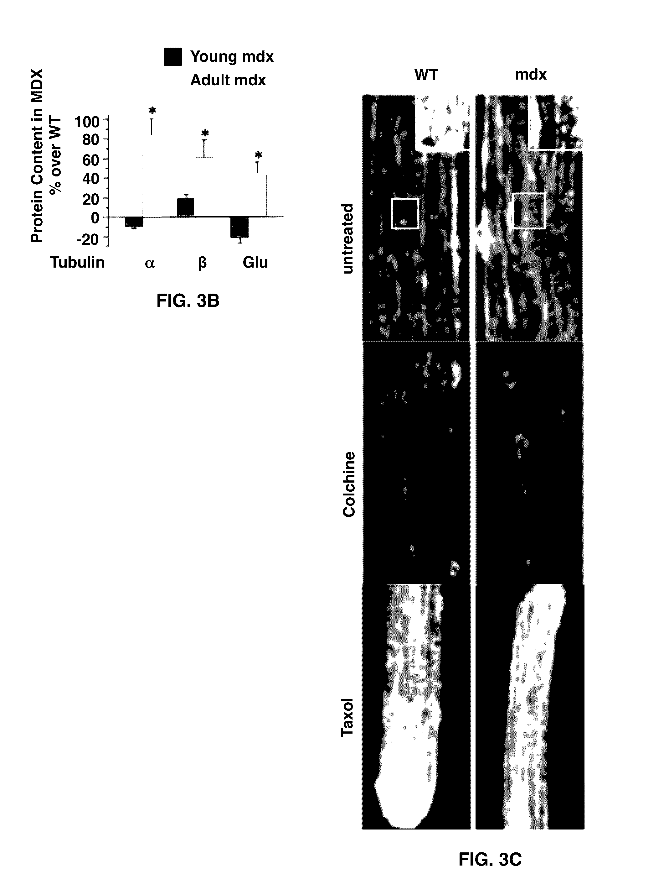 Treatment of muscular conditions and muscular dystrophies