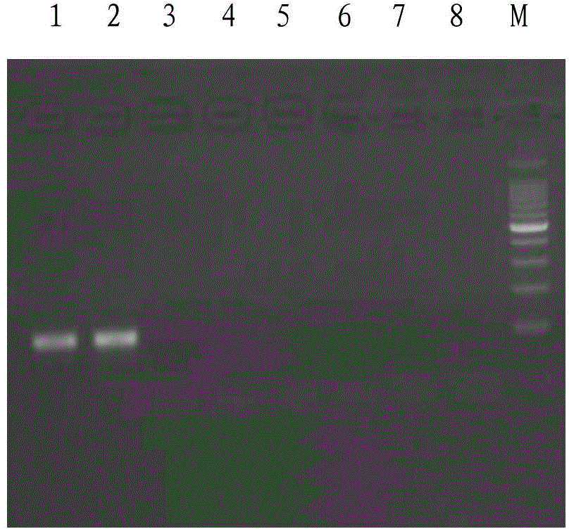 Clonorchis sinensis real-time fluorescence polymerase chain reaction (PCR) detection kit and detection method