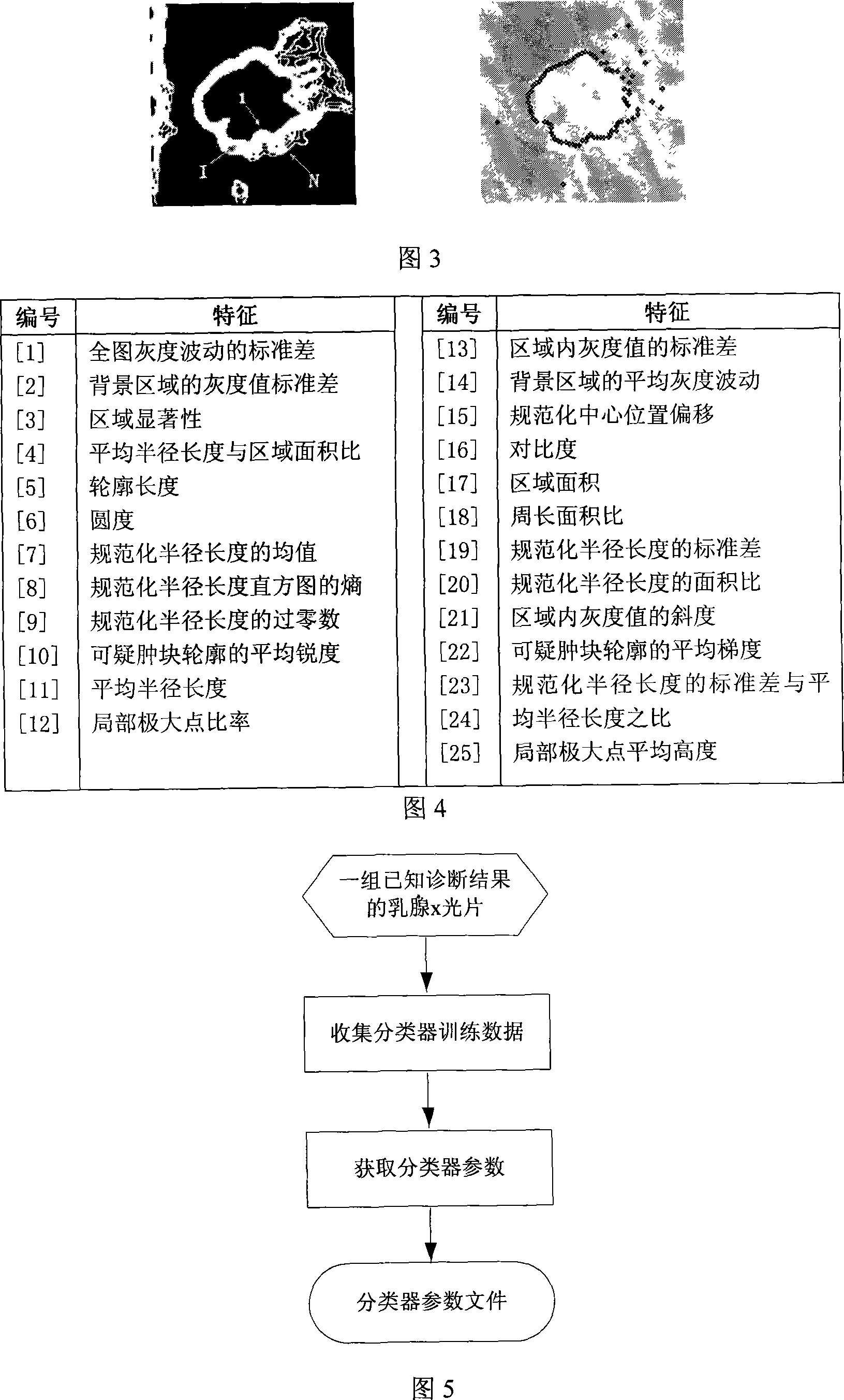 Galactophore cancer computer auxiliary diagnosis method based on galactophore X-ray radiography and system thereof