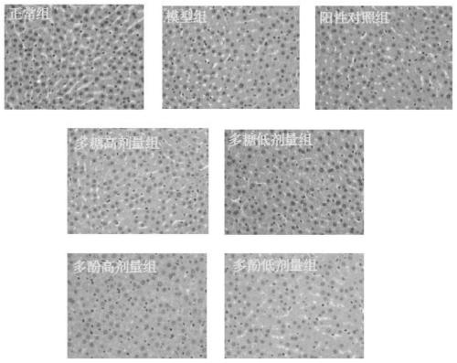 Application of vaccinium dunalianum tea or extract thereof in preparation of medicine for preventing and/or treating type 2 diabetes mellitus