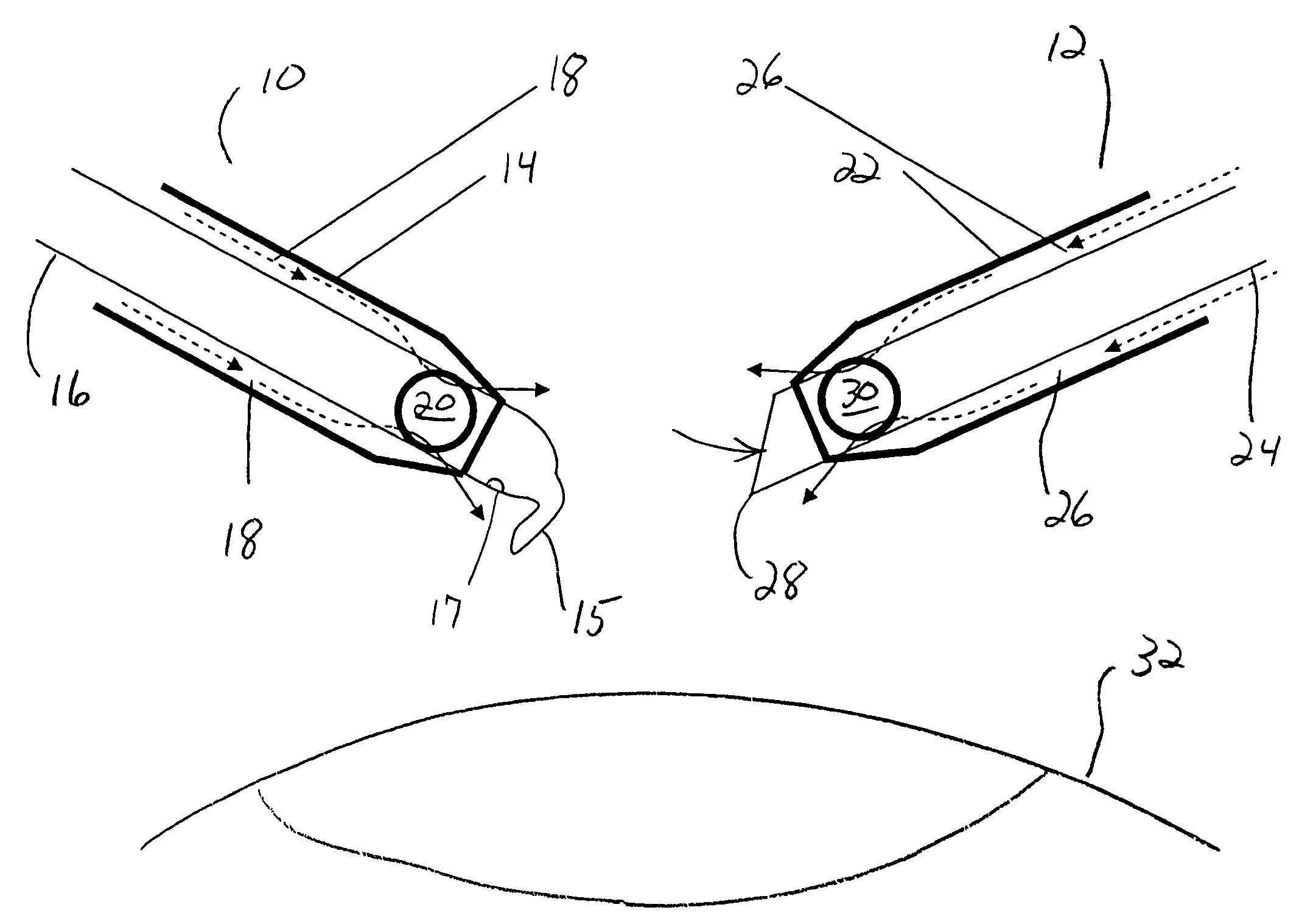 Surgical method and apparatus using dual irrigation paths