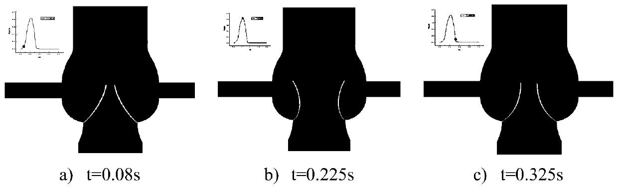 Aortic valve fluid-solid coupling numerical simulation method based on CT medical image data