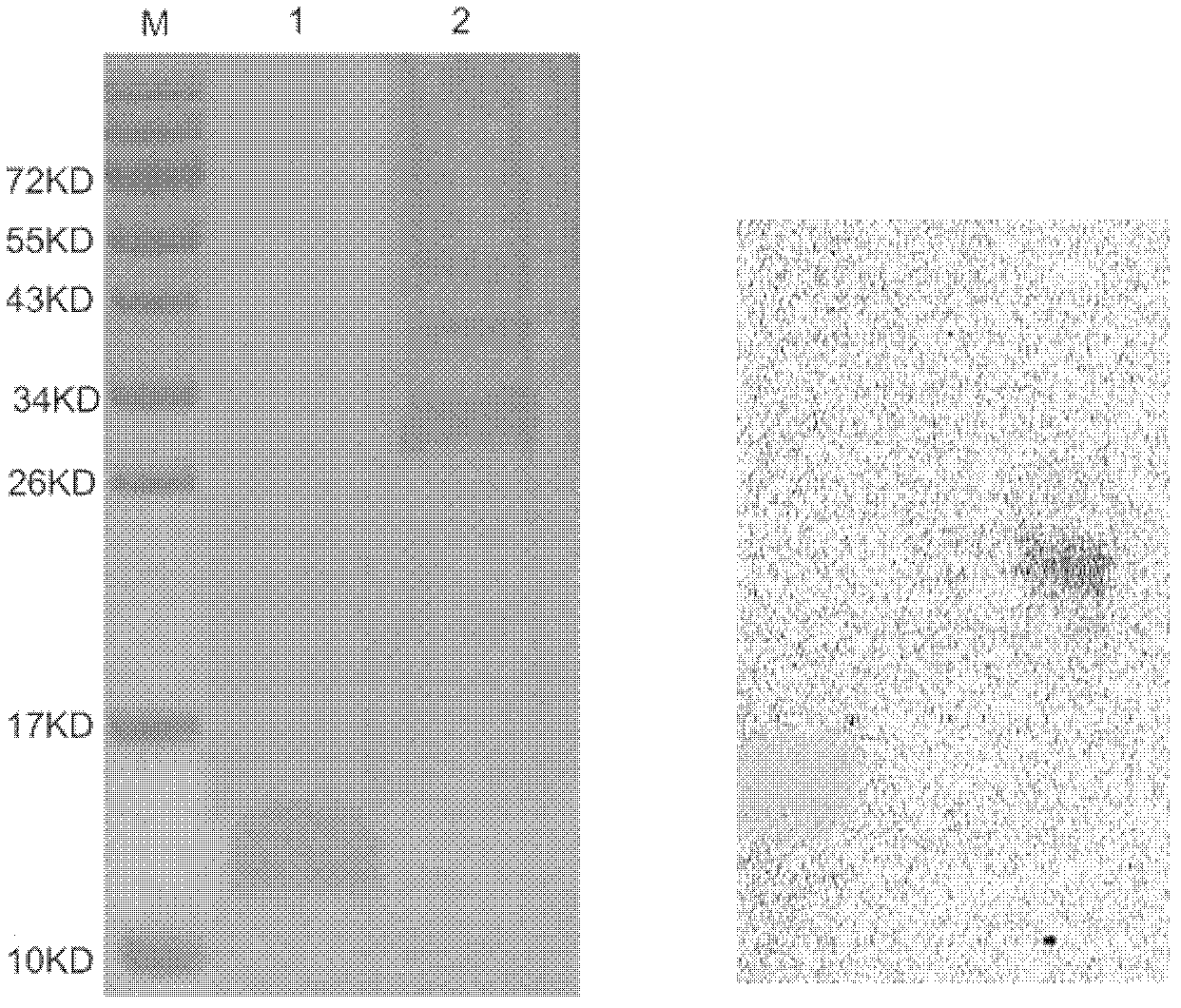 Human serum amyloid A1 and preparation method and application thereof