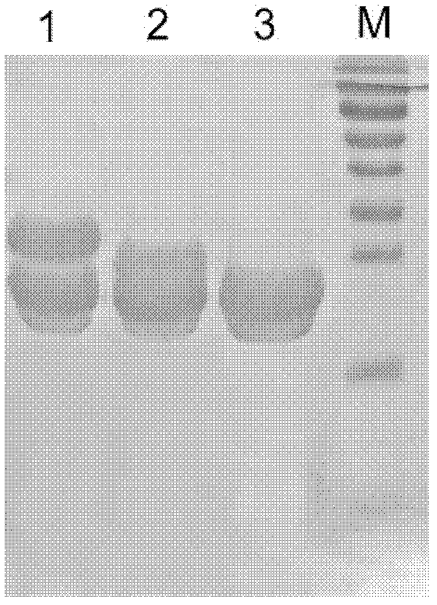 Human serum amyloid A1 and preparation method and application thereof