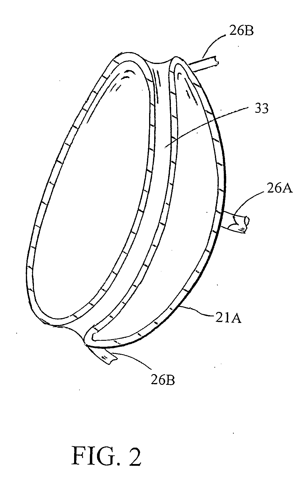 Intragastric space filler