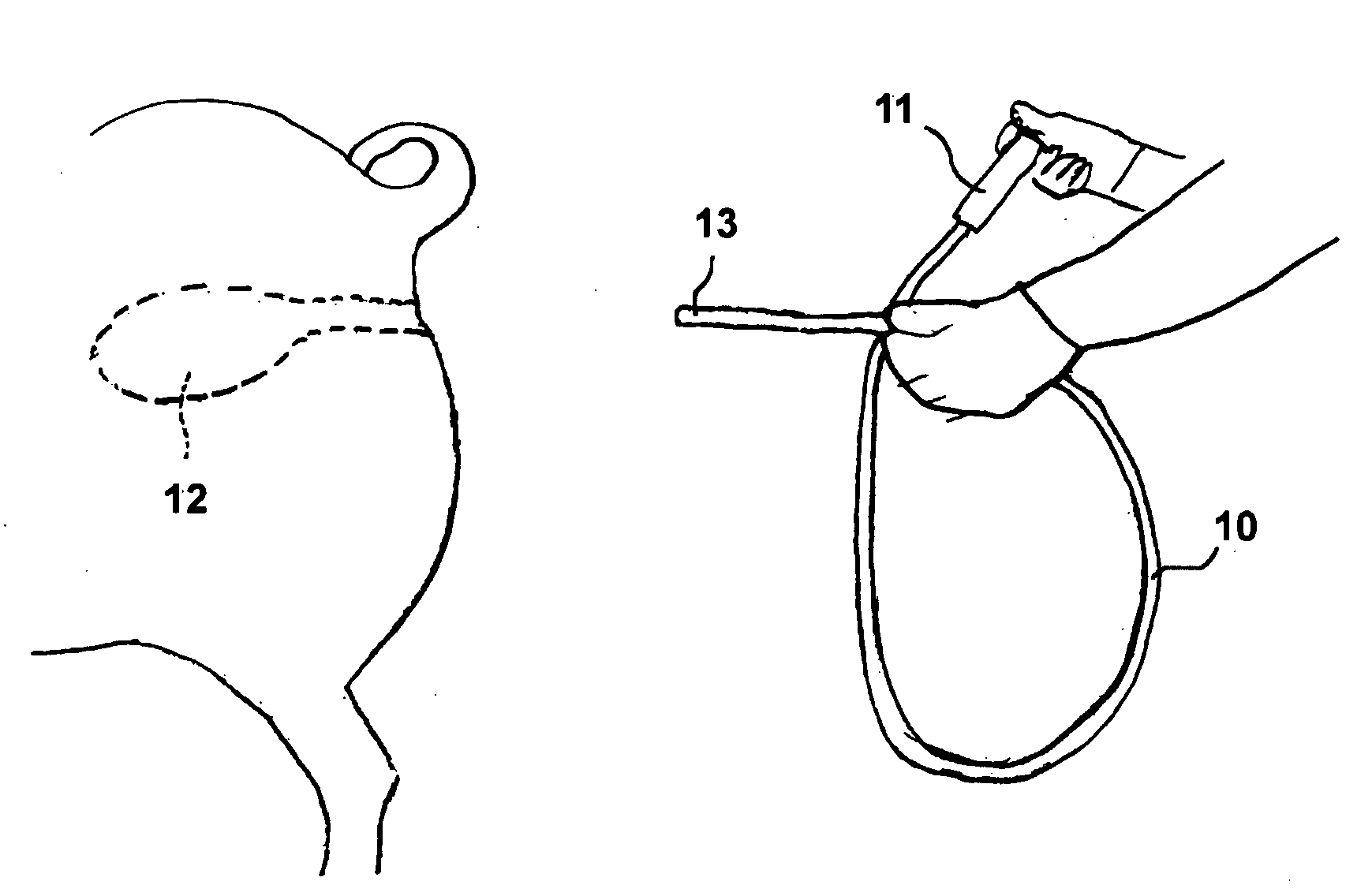 Method of Raising Livestock