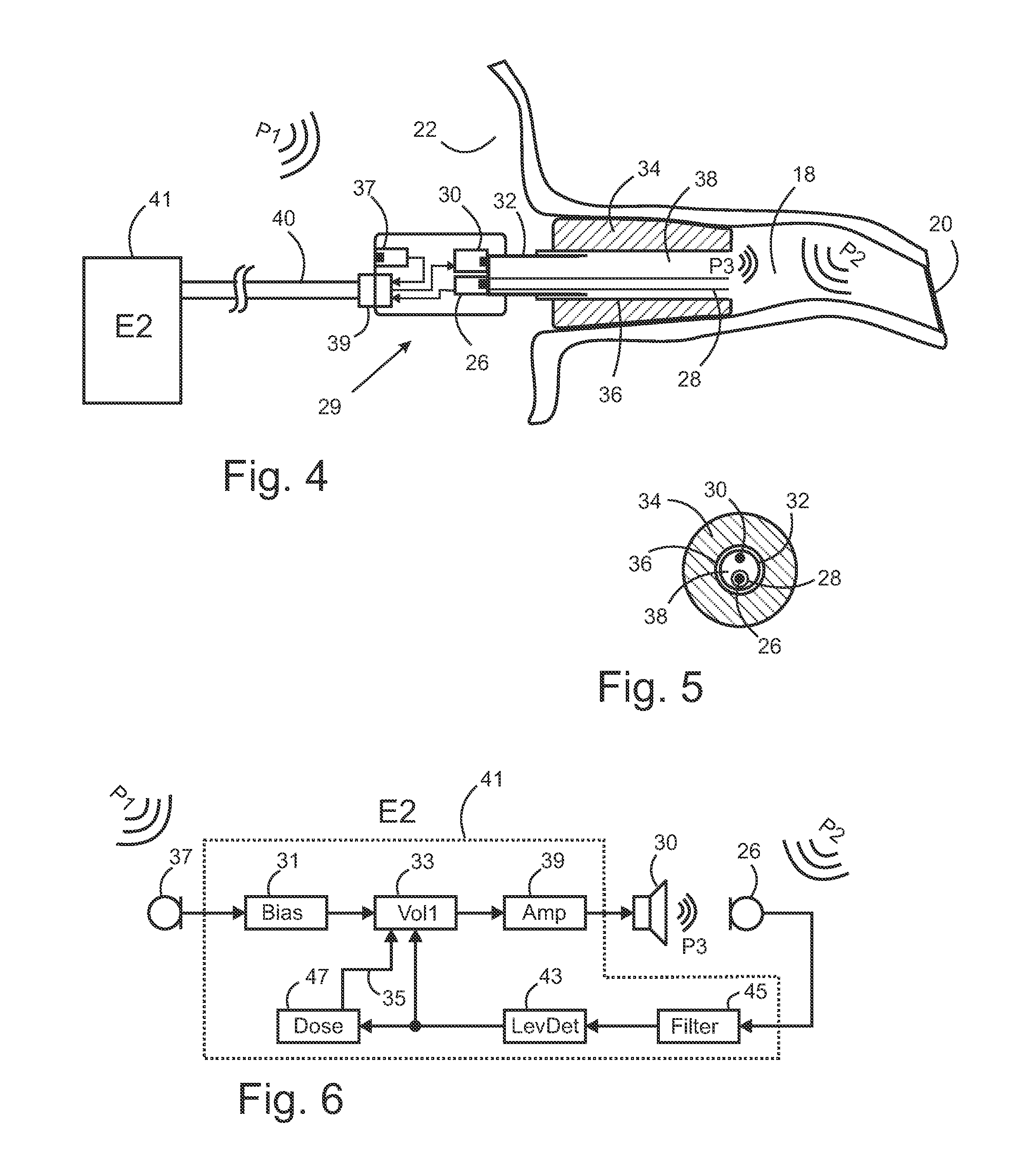 Hearing Protection with Sound Exposure Control and Monitoring