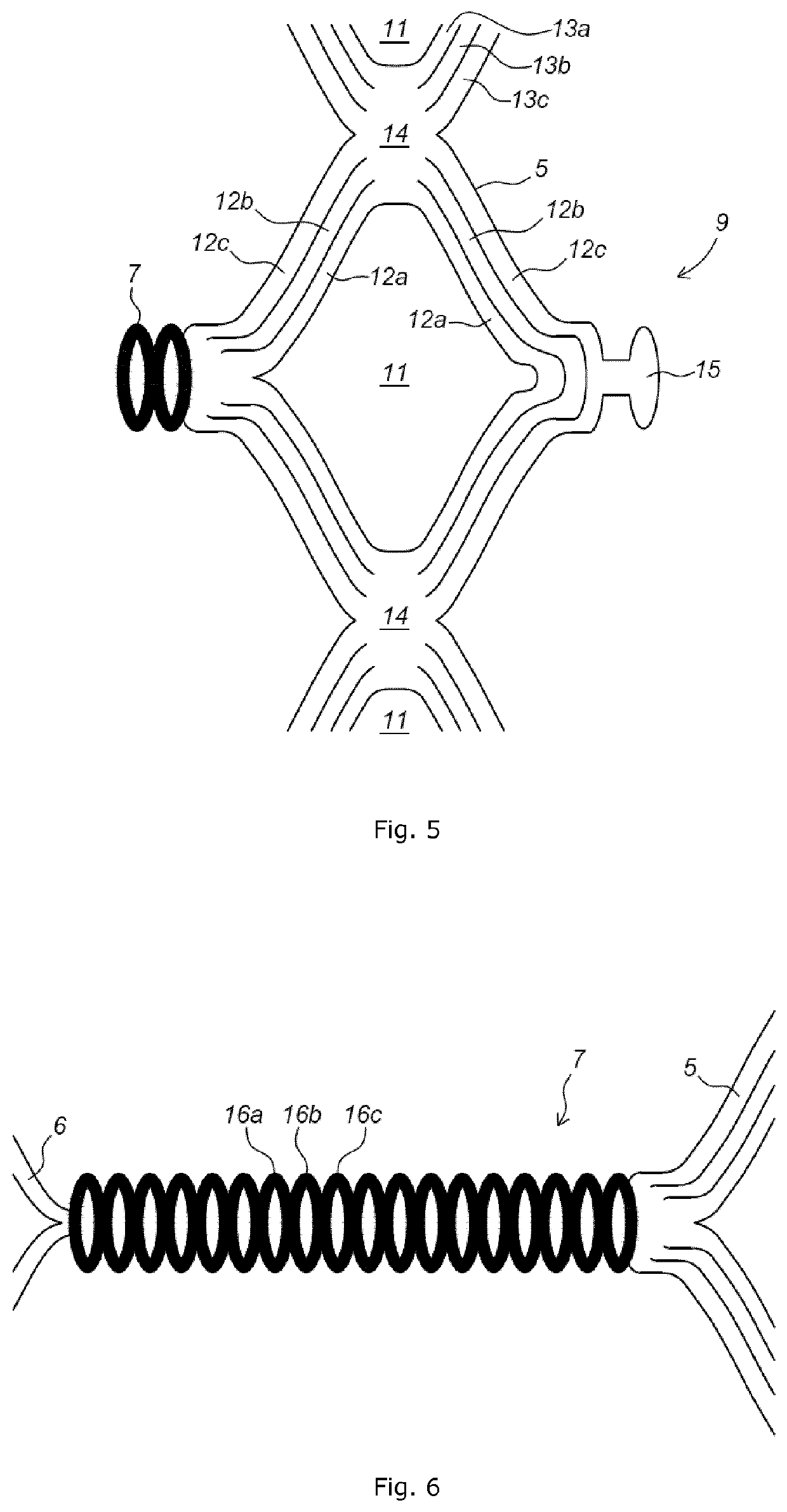 Implant stent device