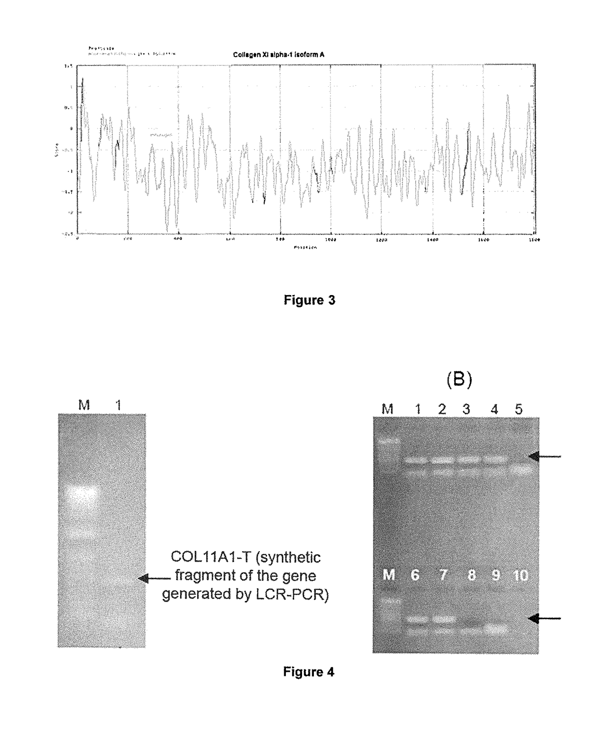 Methods and products for in vitro diagnosis, in vitro prognosis and the development of drugs against invasive carcinomas