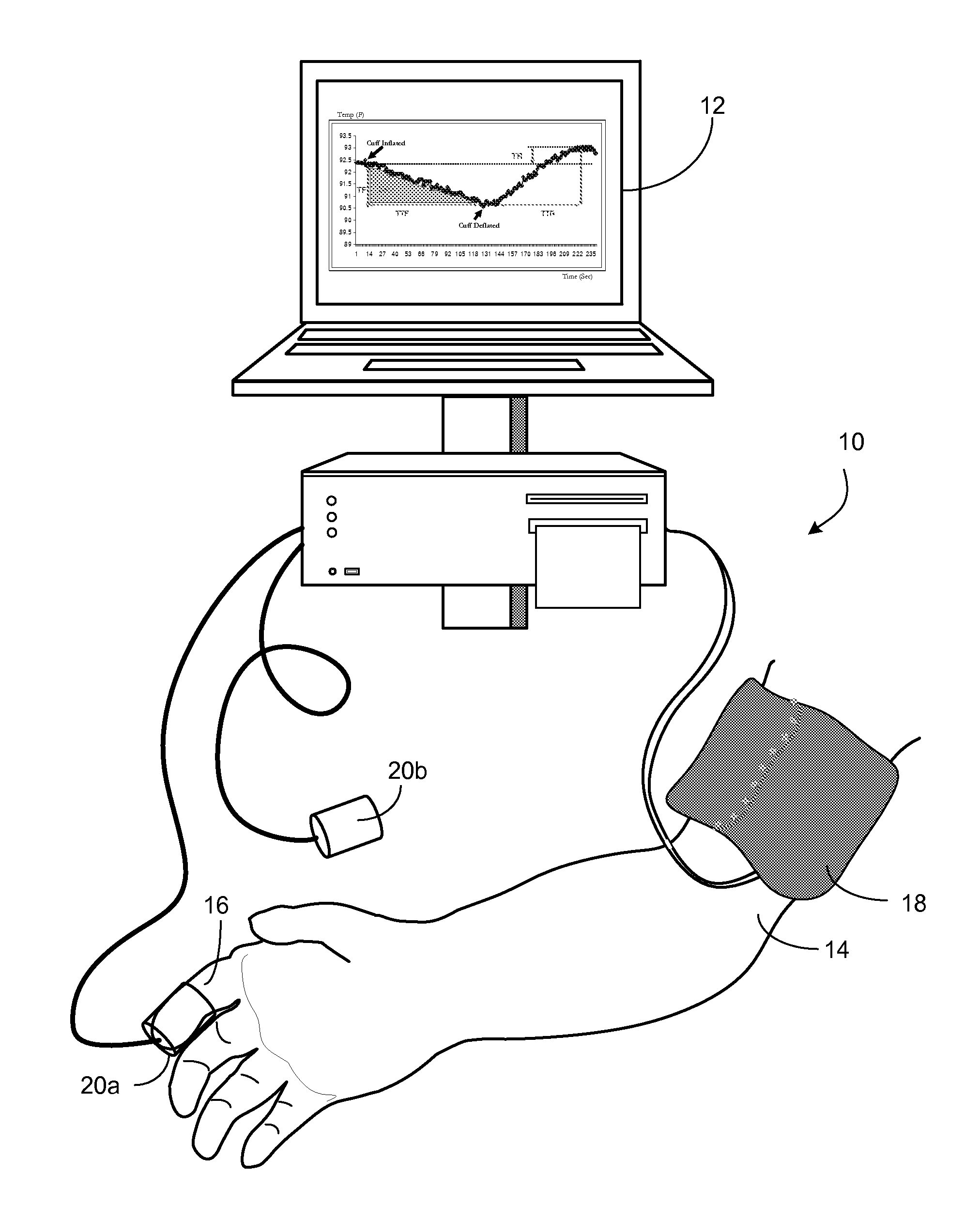 Methods and Apparatus for Profiling Cardiovascular Vulnerability to Mental Stress