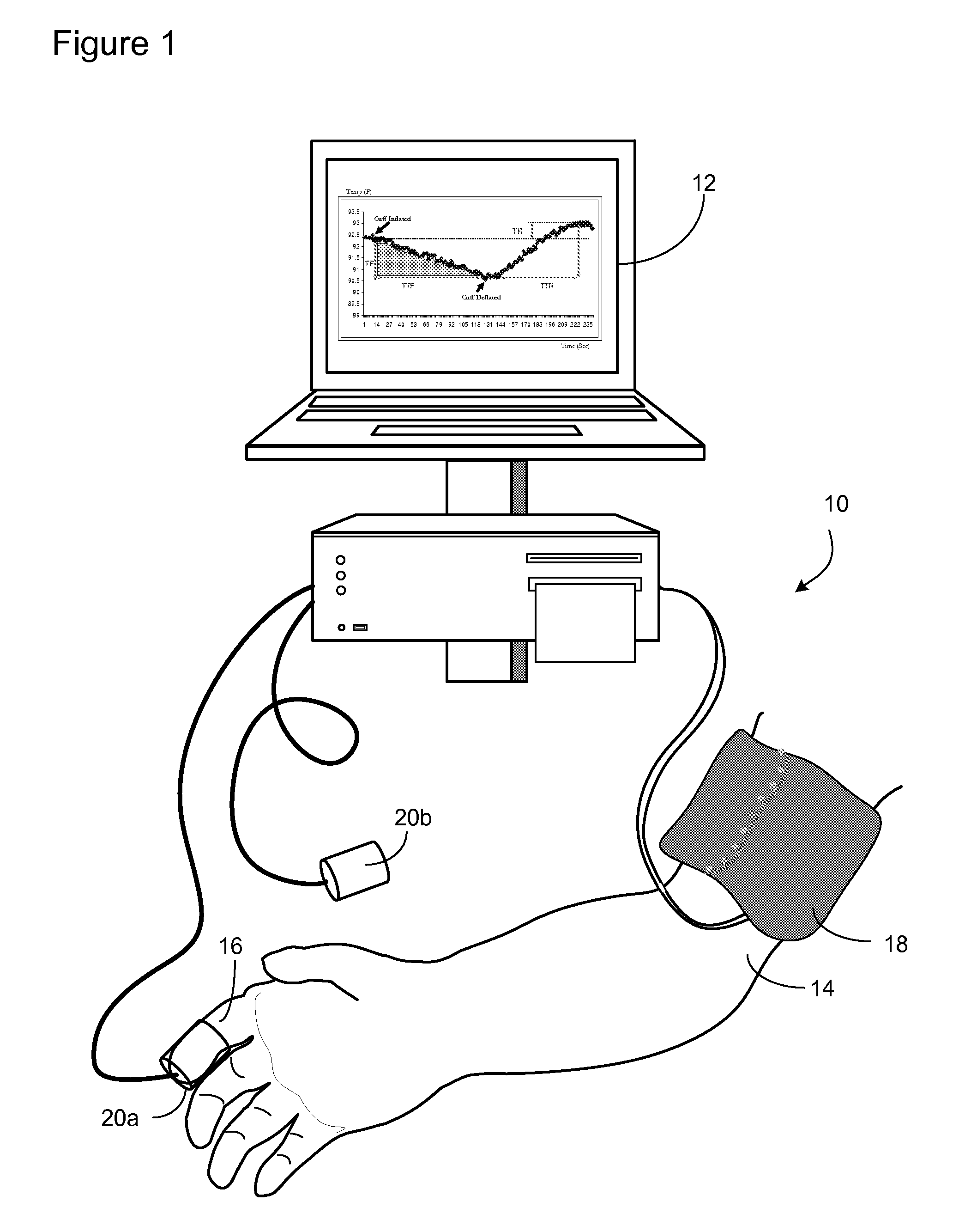 Methods and Apparatus for Profiling Cardiovascular Vulnerability to Mental Stress