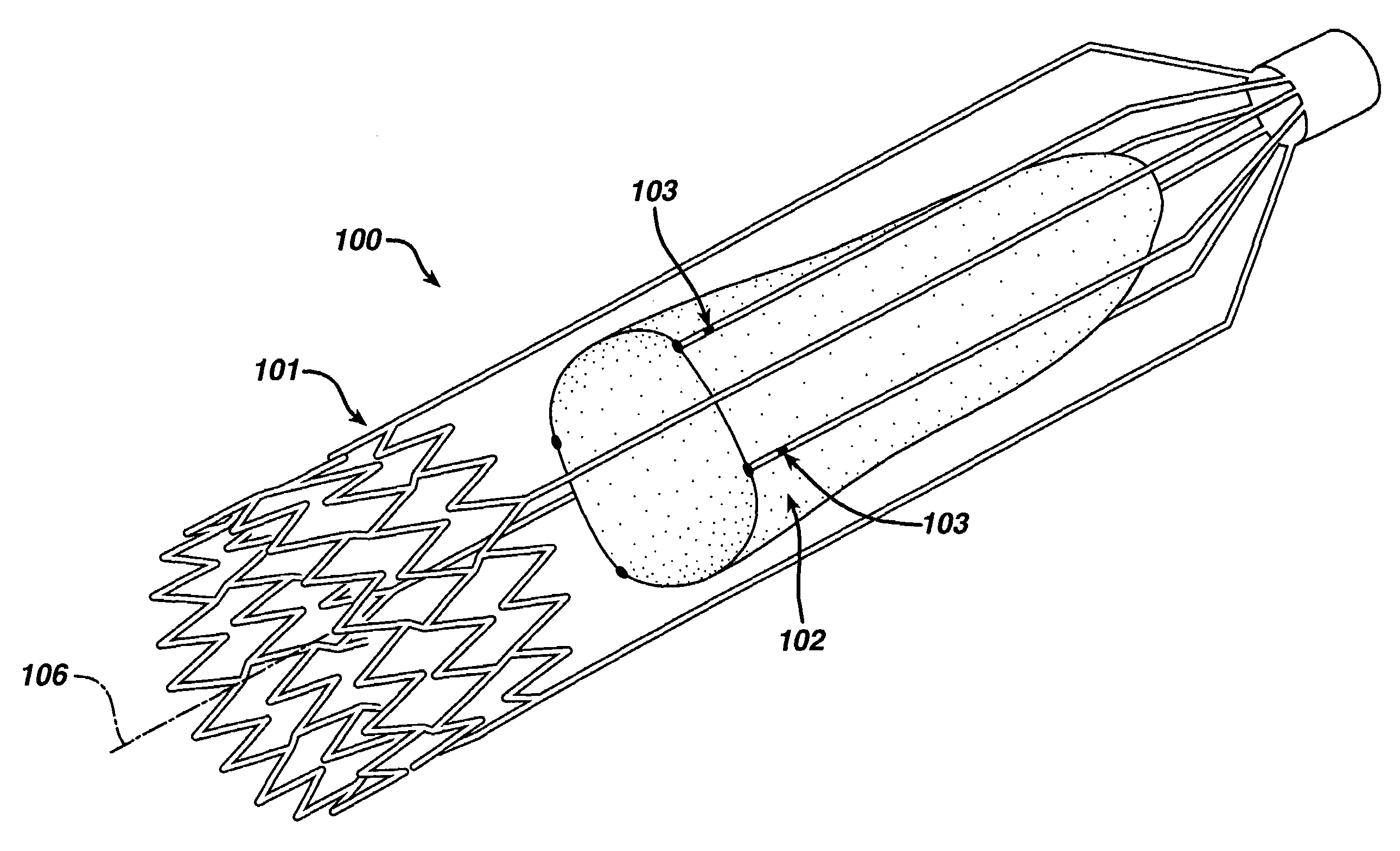 Implantable valvular prosthesis