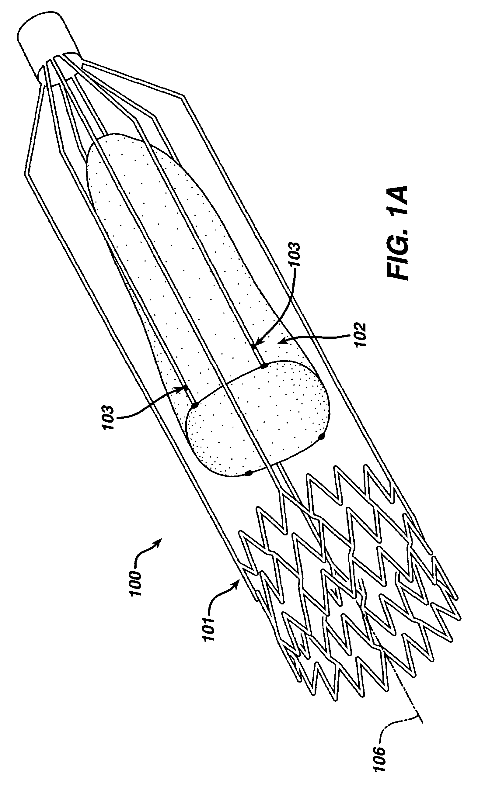 Implantable valvular prosthesis