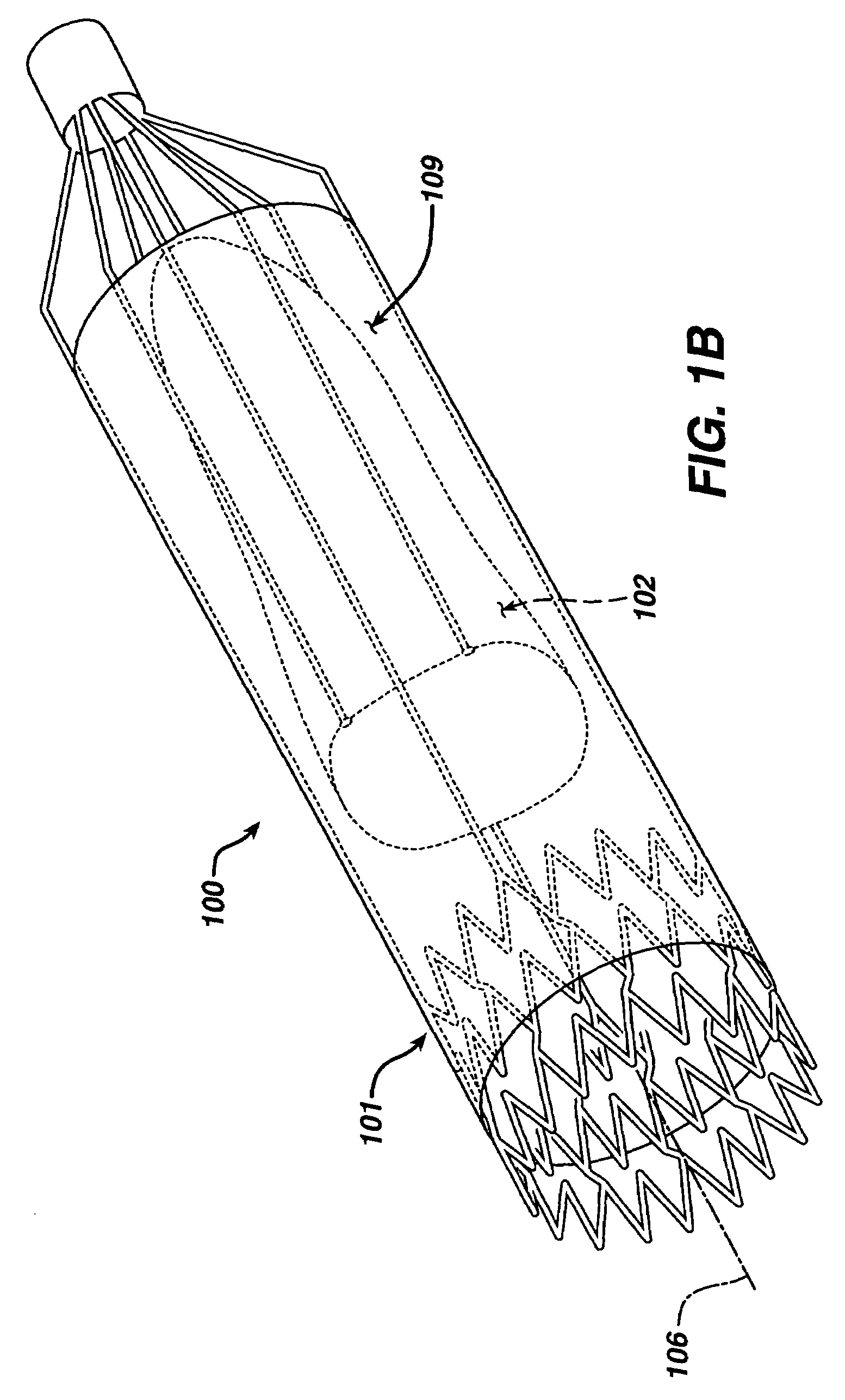 Implantable valvular prosthesis