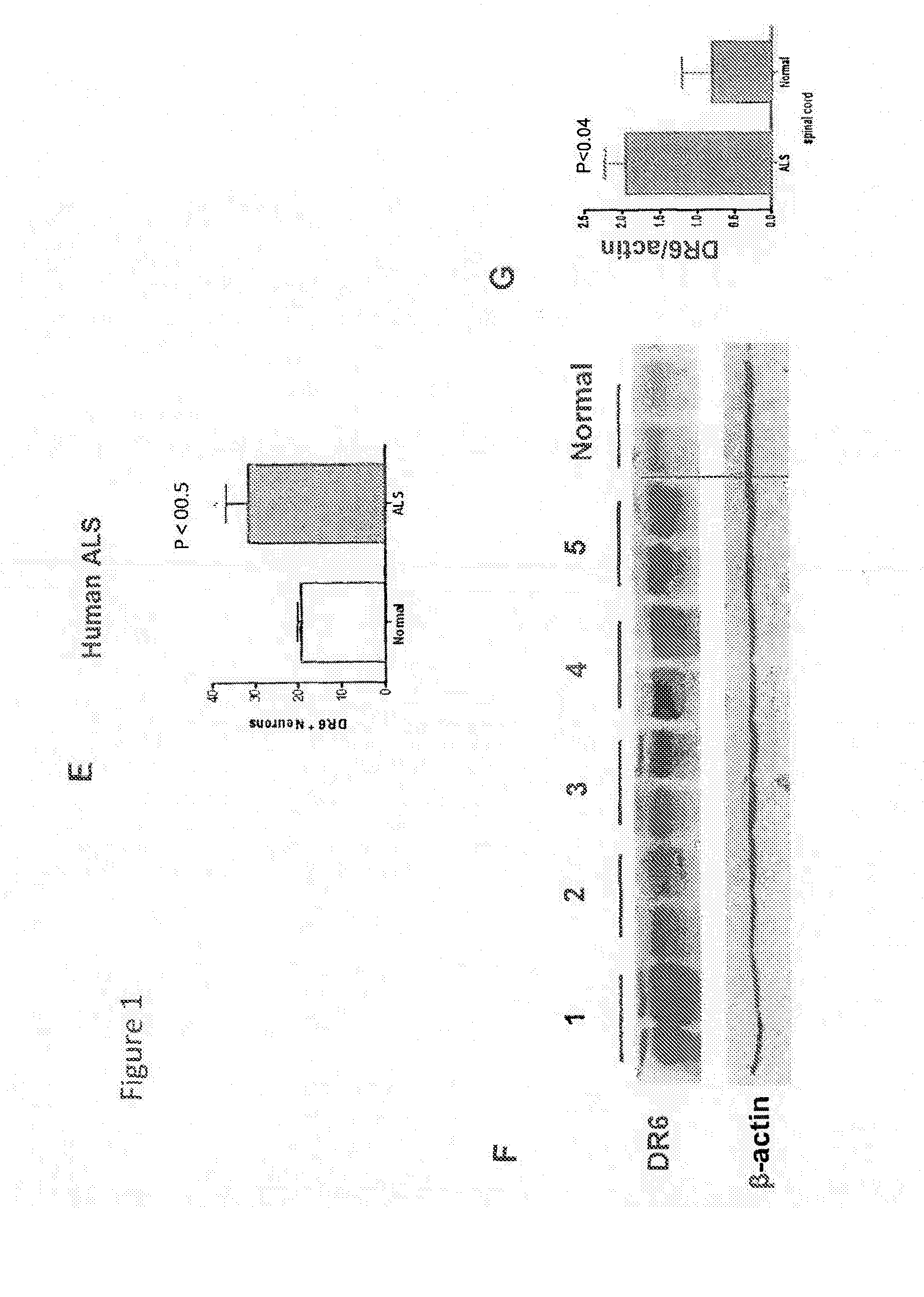 Use of DR6 Antagonists to Improve Motor Neuron Disease