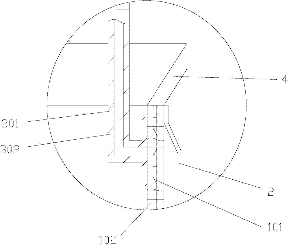 Expandable esophageal stent