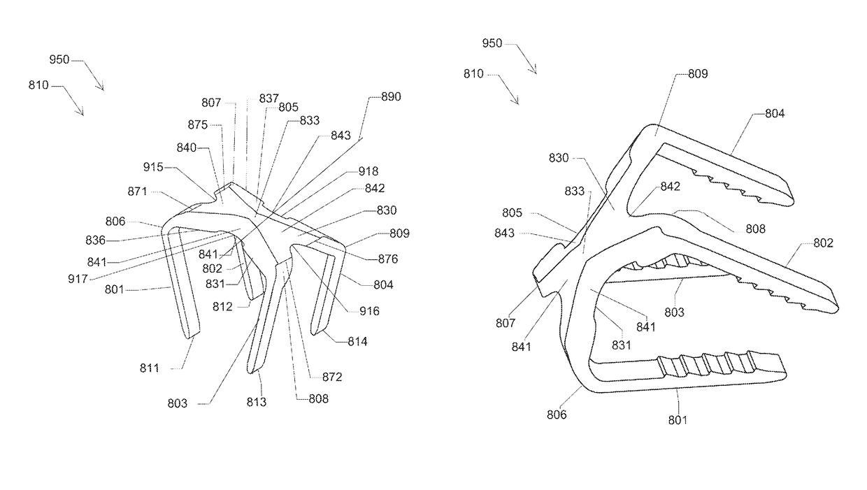 Elastic orthopedic implant and method of manufacturing thereof