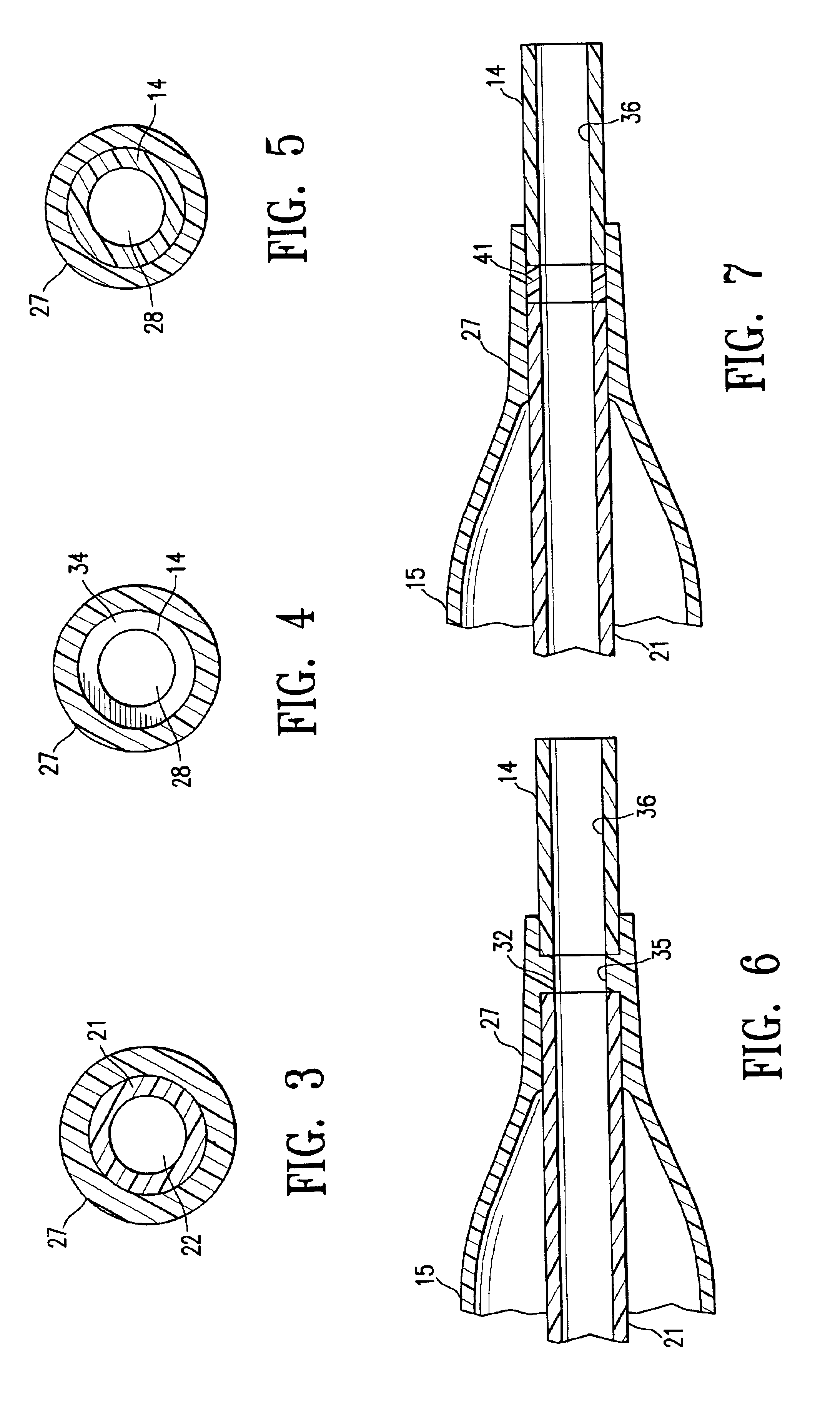 Catheter having a soft distal tip