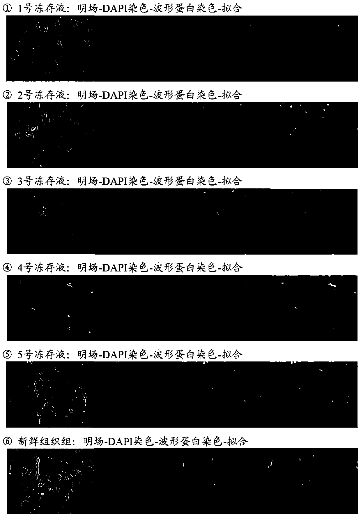 Tissue and/or cell cryopreservation protection solution and its preparation and application