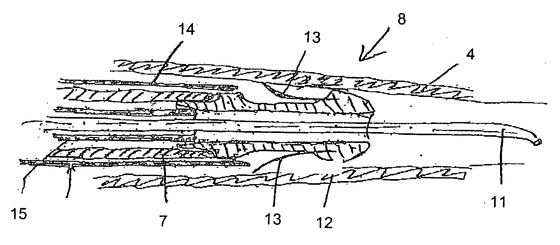 Hemocirculatory catheter and method of use thereof