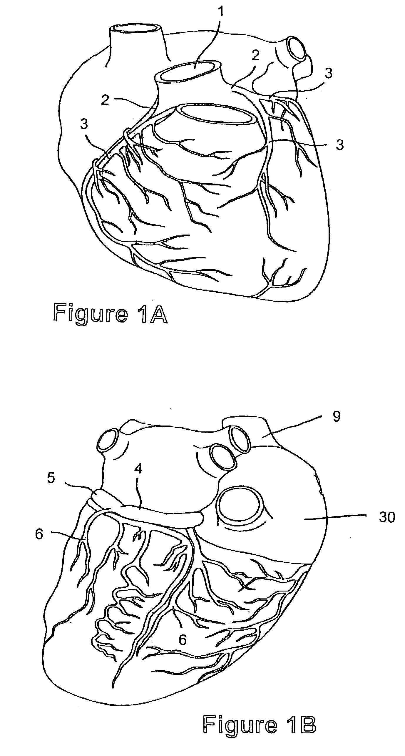 Hemocirculatory catheter and method of use thereof