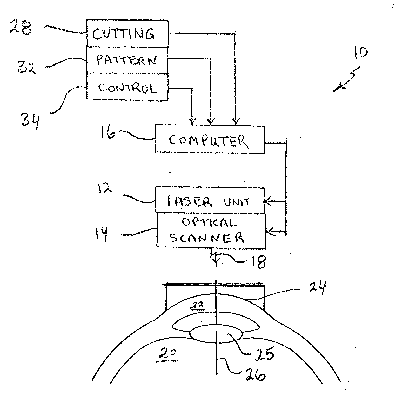 System and Method for Minimizing the Side Effects of Refractive Corrections Using Line or Dot Cuts for Incisions