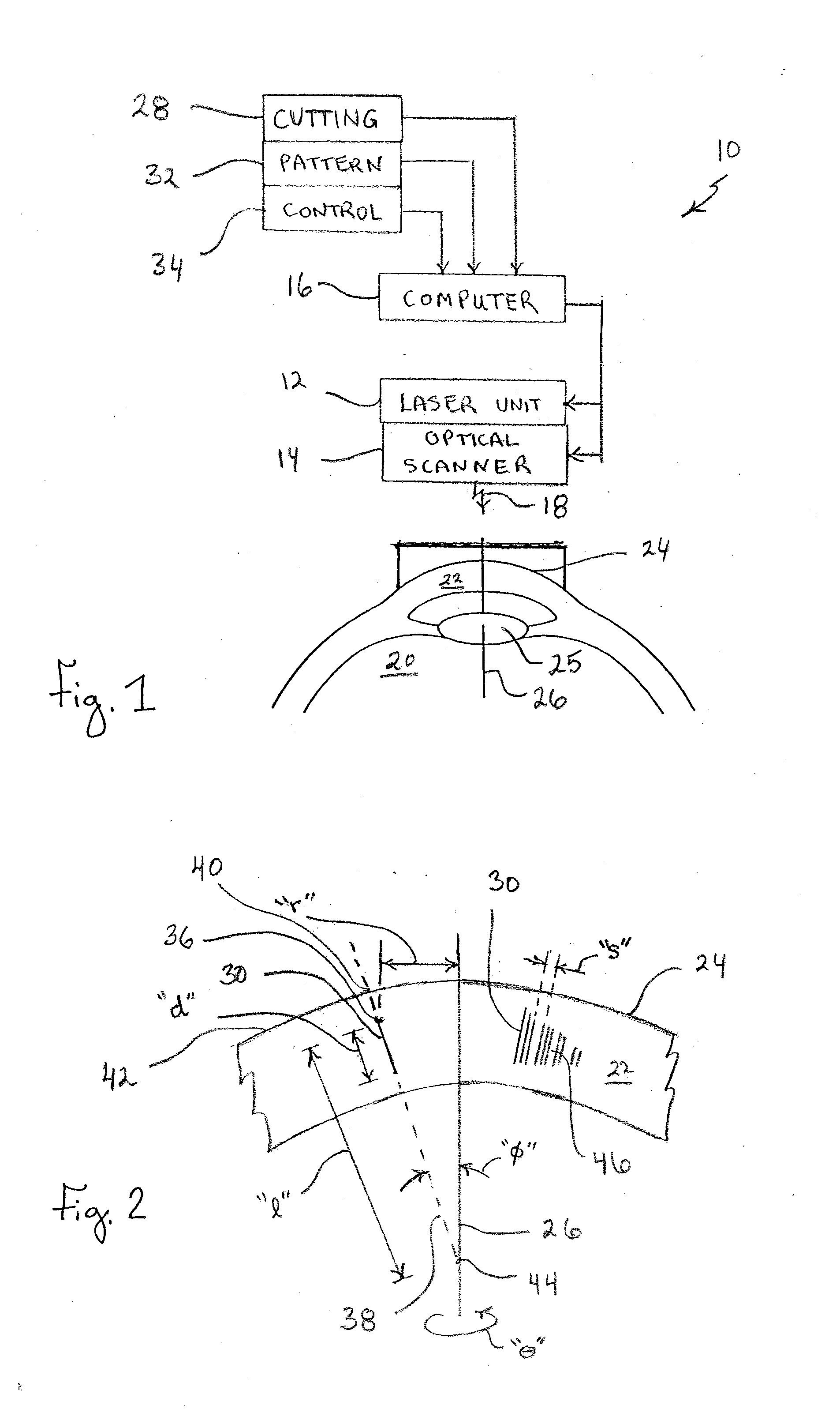 System and Method for Minimizing the Side Effects of Refractive Corrections Using Line or Dot Cuts for Incisions