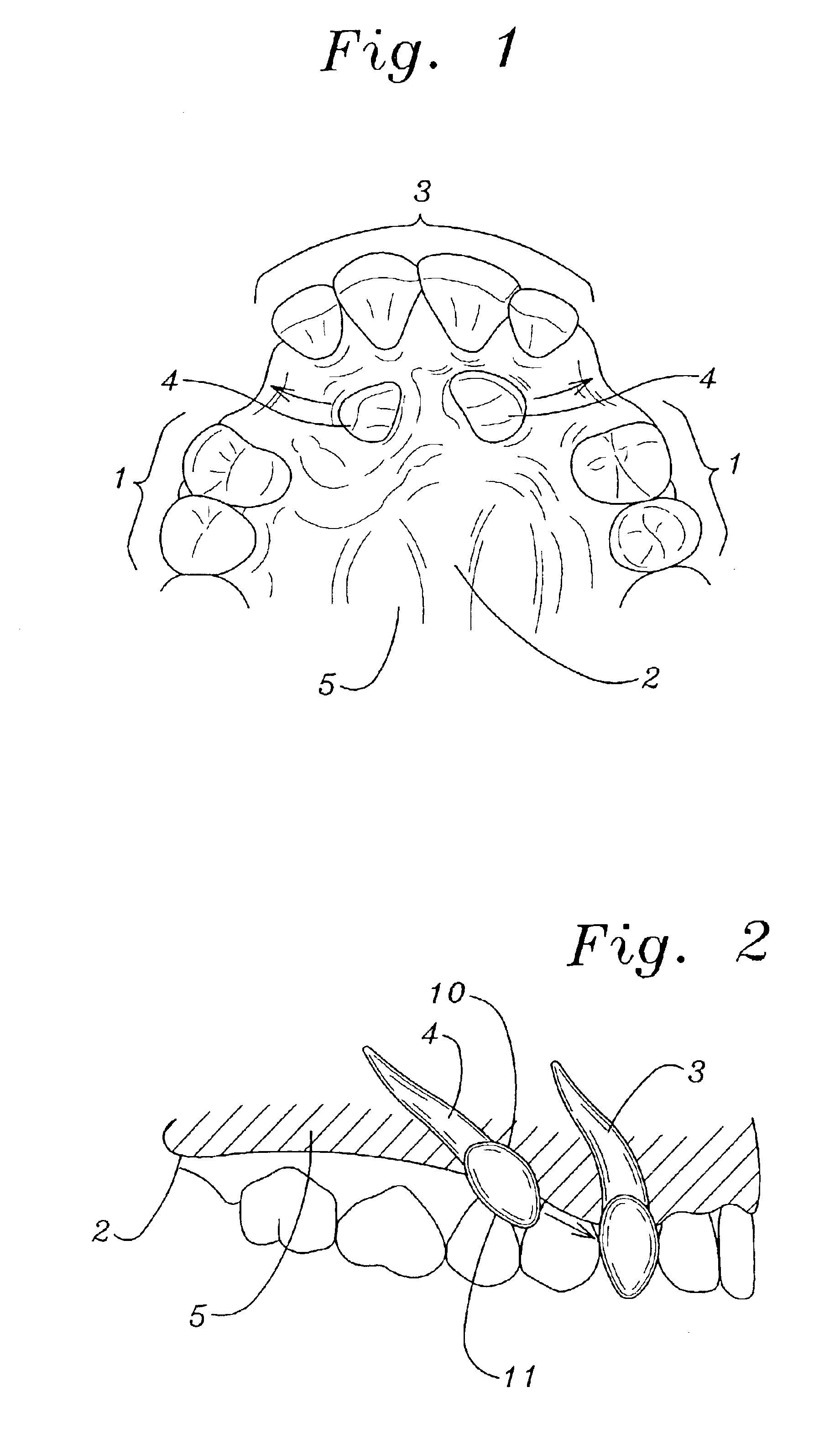 Attachment offset tooth eyelet