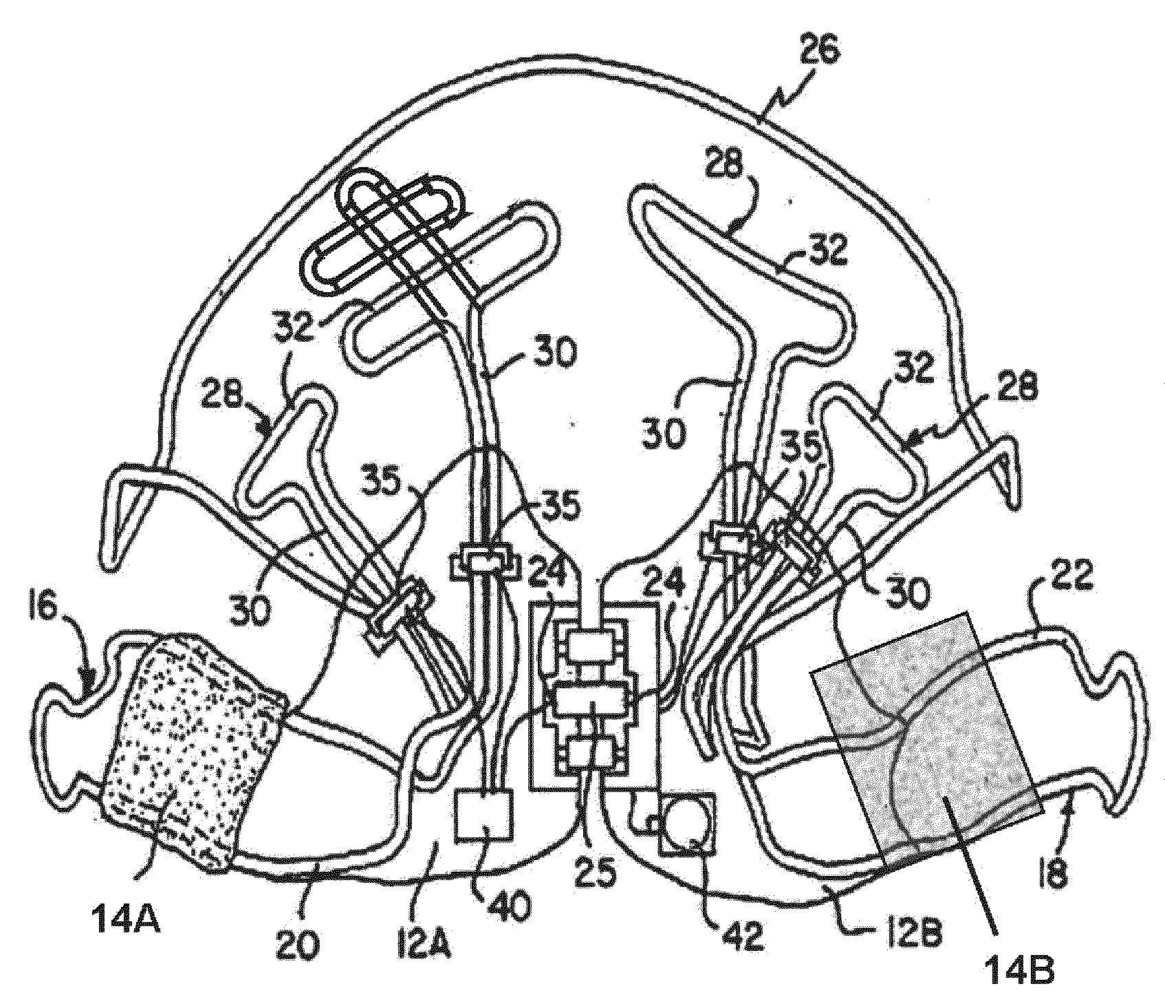 Osteogenetic-orthodontic device, system, and method