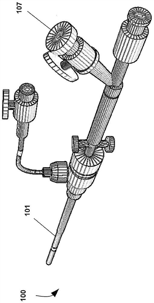 Endoprosthesis for a total vascular exclusion of the liver