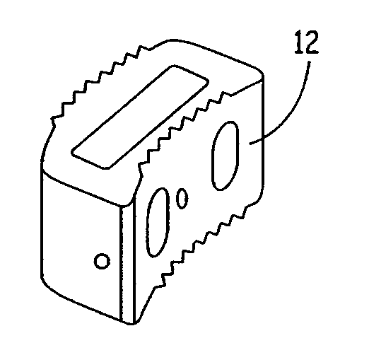 Expandable osteoimplant