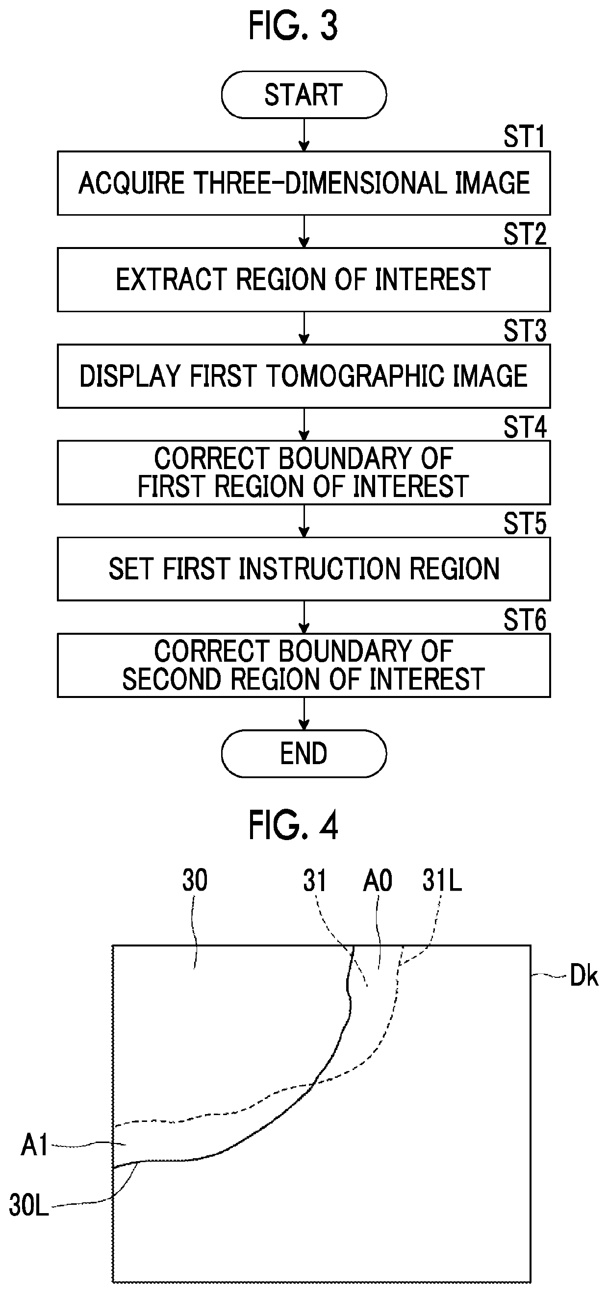 Region correction apparatus, region correction method, and region correction program