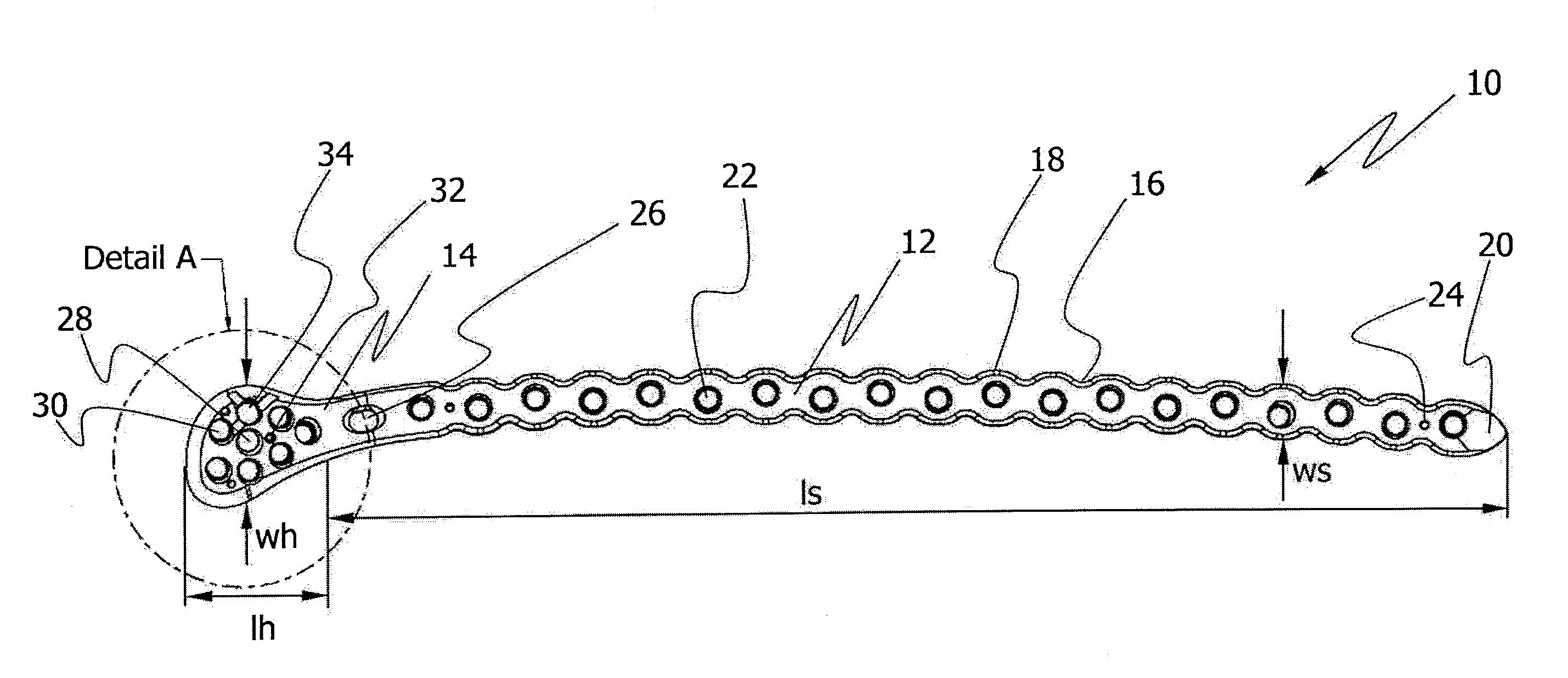 Implant for bone fixation