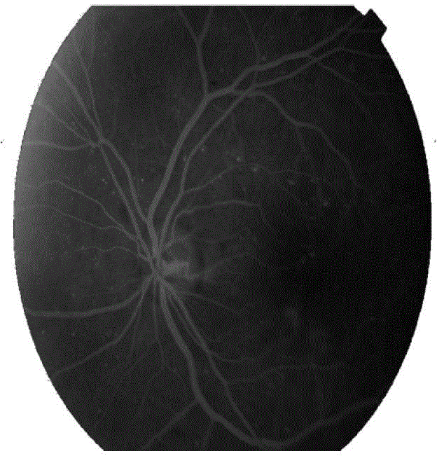 Eye fundus image registration method, eye fundus image optic disk nerve and vessel measuring method and eye fundus image matching method